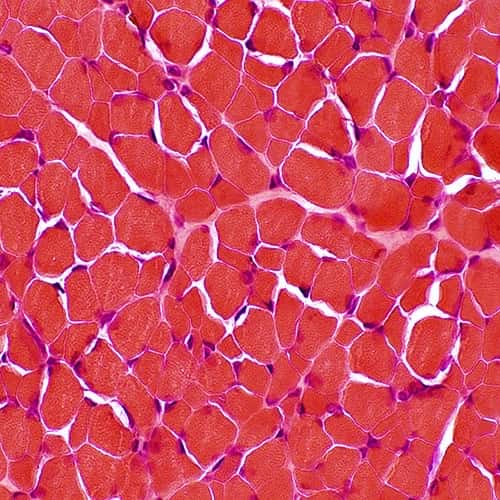 Muscle fibers in cross section, under a microscope