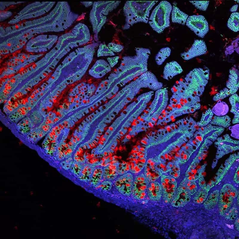 Gut lining cells under a fluorescence microscope