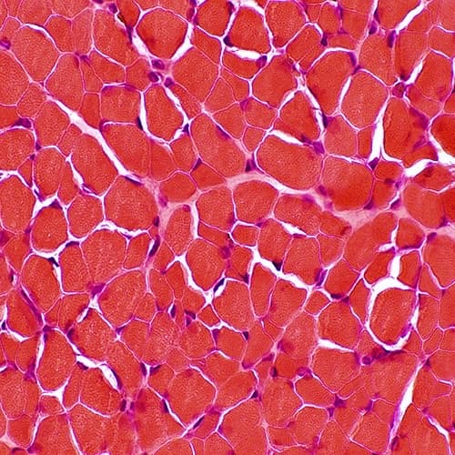 Muscle fibers in cross section, under a microscope