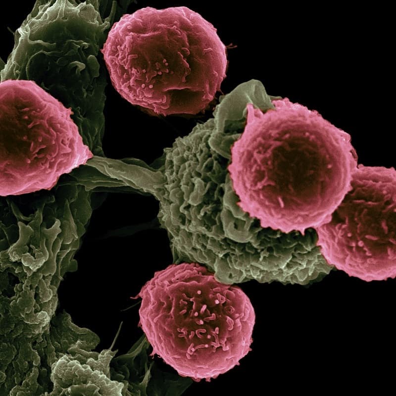 Immune cells under an electron microscope